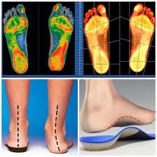 tabanlık için ayak analizi